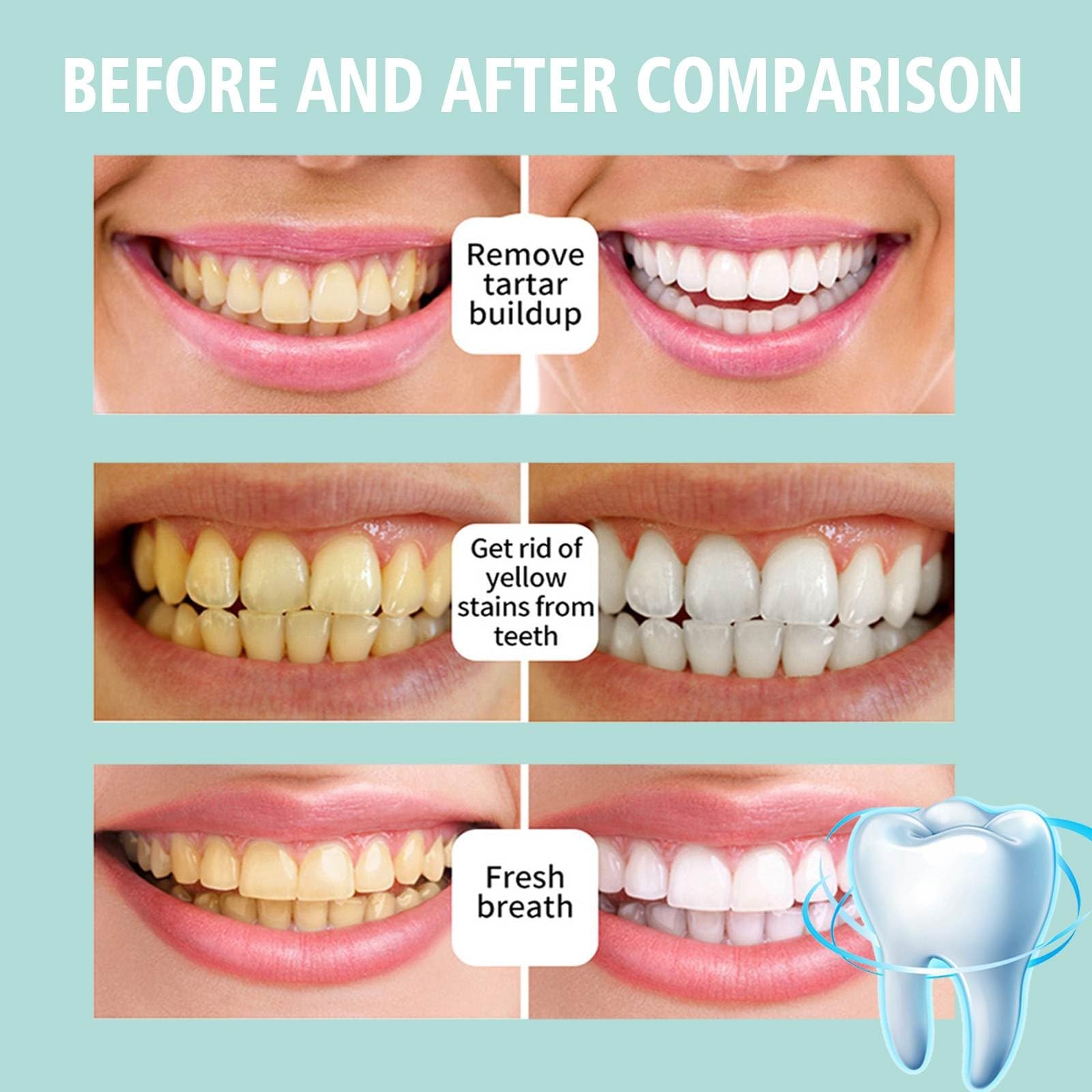 2PCS Foam Toothpaste for Sensitive Teeth - Ultra-fine Mousse, Deep Clean & Stain Removal (2 Pack)
