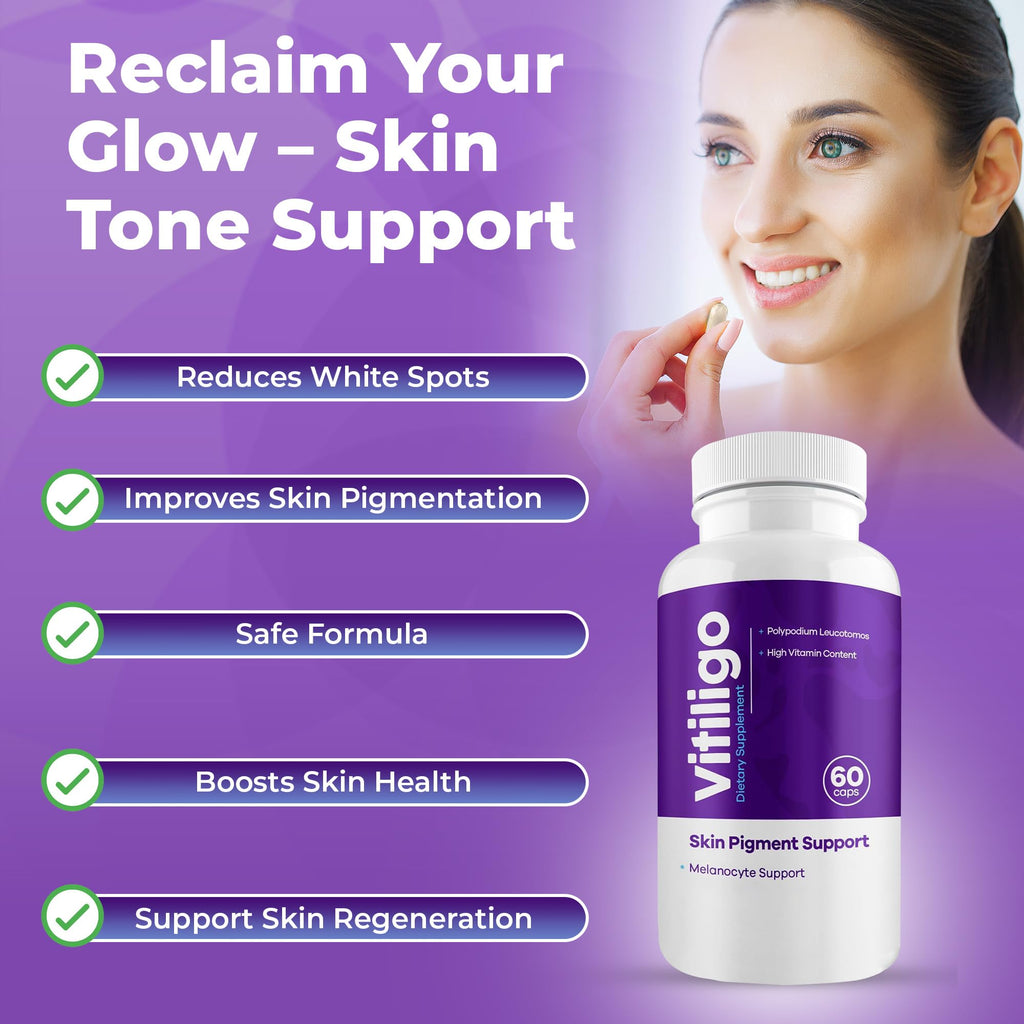 Aura Vitamins Vitiligo Capsules – 60 Count | Pigmentation Support & White Spots
