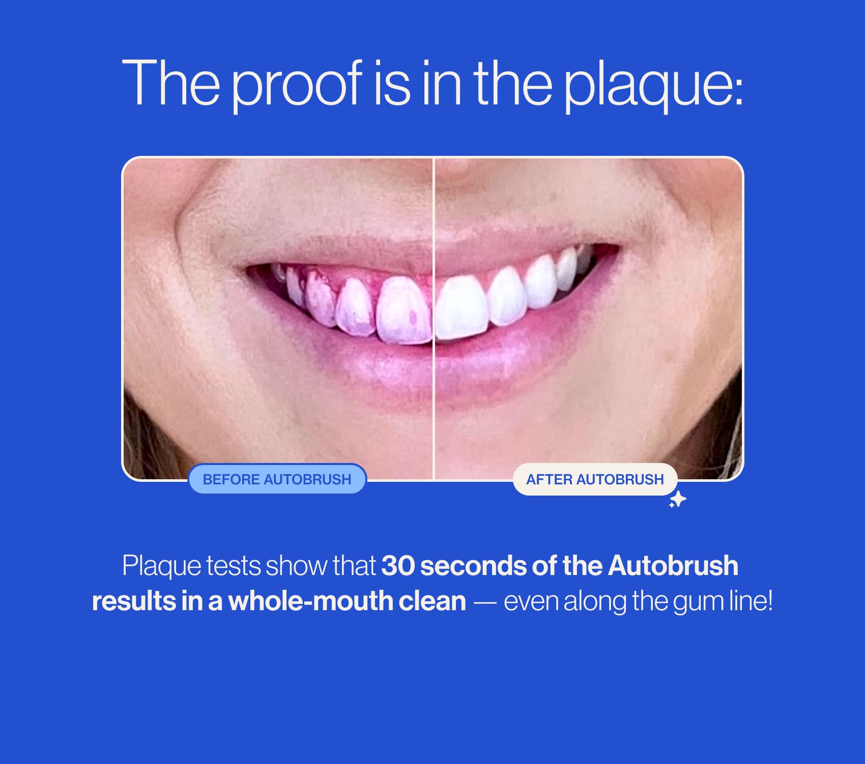 autobrush Kids Electric Toothbrush – ADA-Accepted U-Shaped, 5.1x Cleaner, 30s Clean, 360° Coverage, LED Lights & Music, Ages 3-5 (Lion)