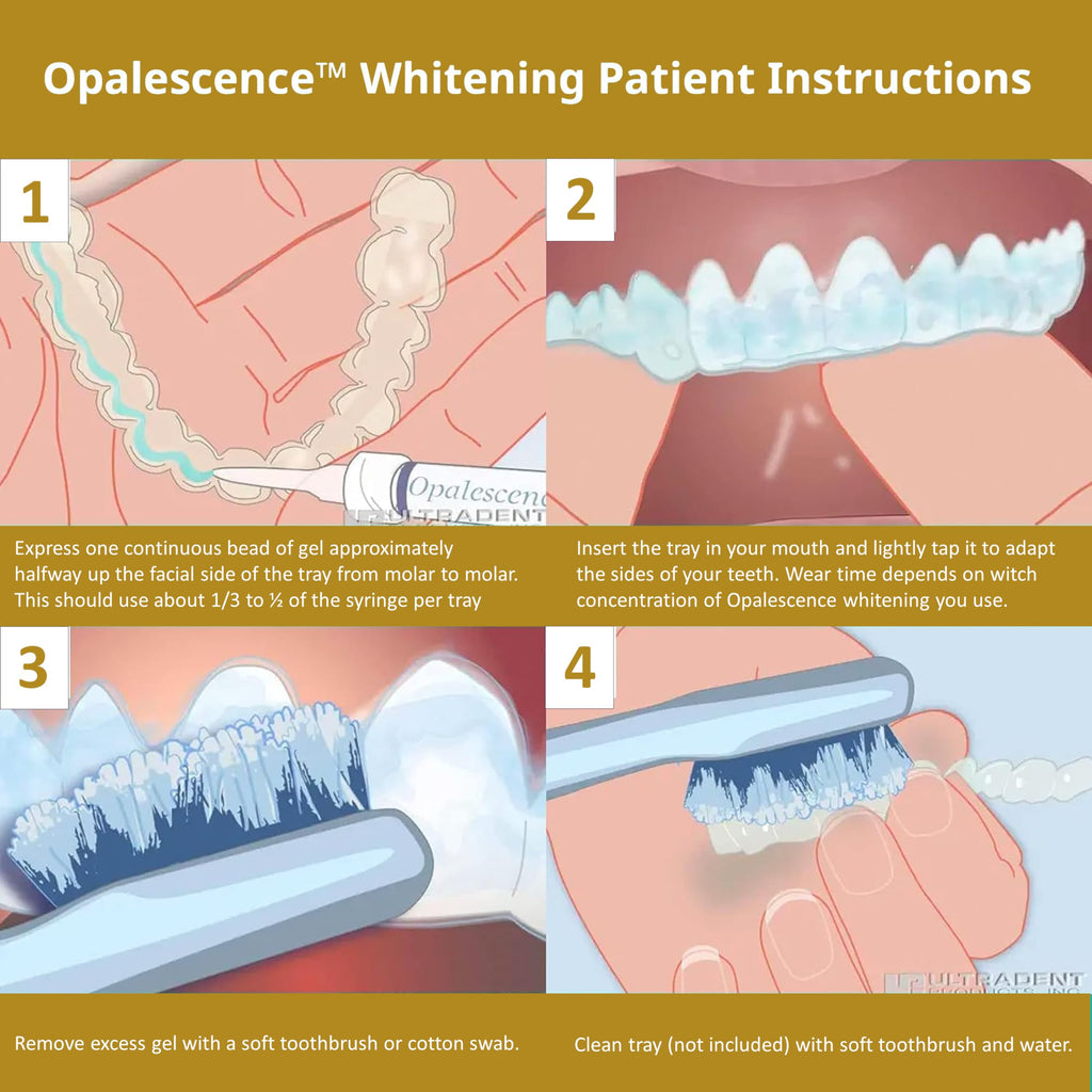 Opalescence 45% Teeth Whitening Gel – 8-Syringe Refill Kit (Mint, PF) by Ultradent