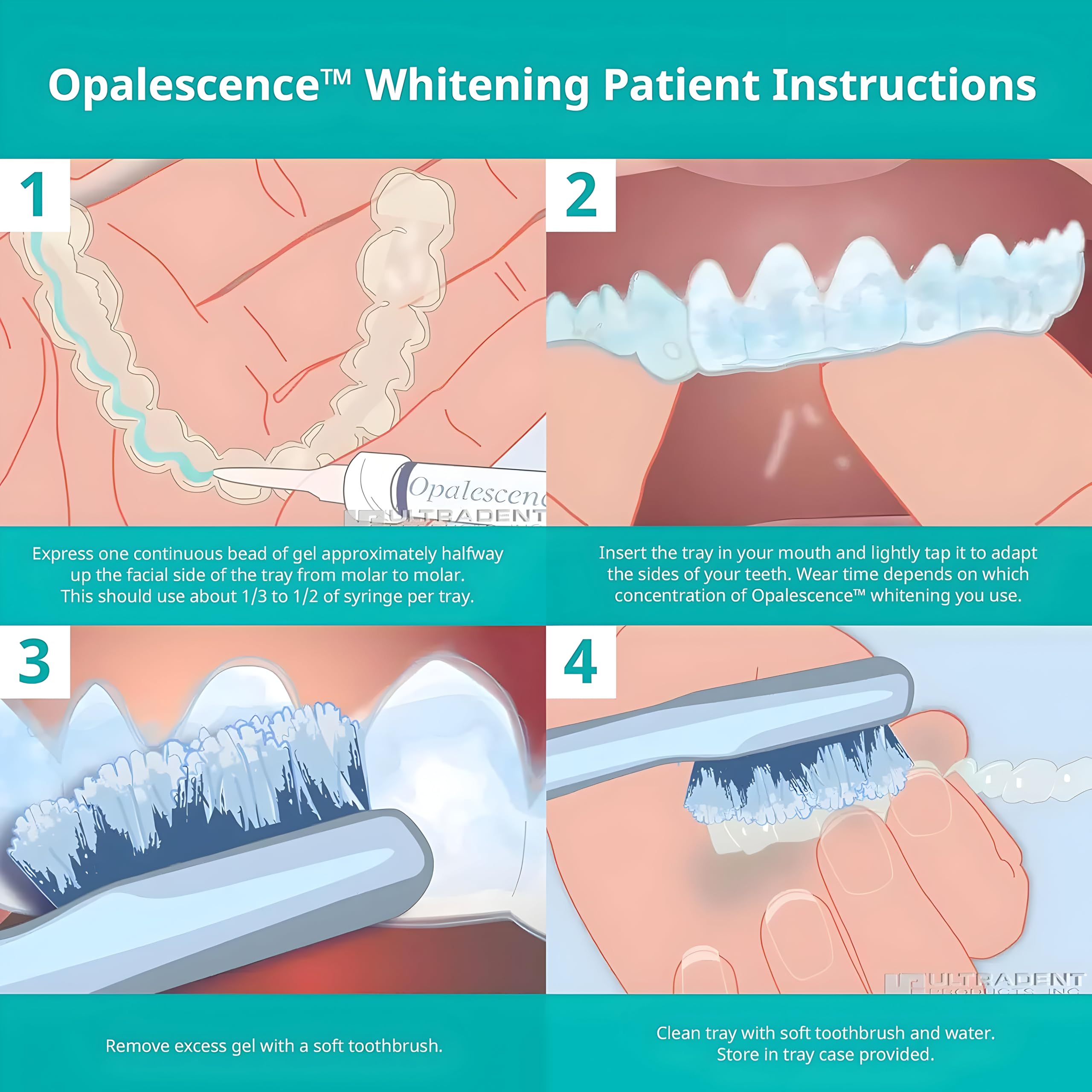 Opalescence 15% Teeth Whitening Refills – 4 Syringes, Low Sensivity, Cool Mint – Made in USA (5195-2)