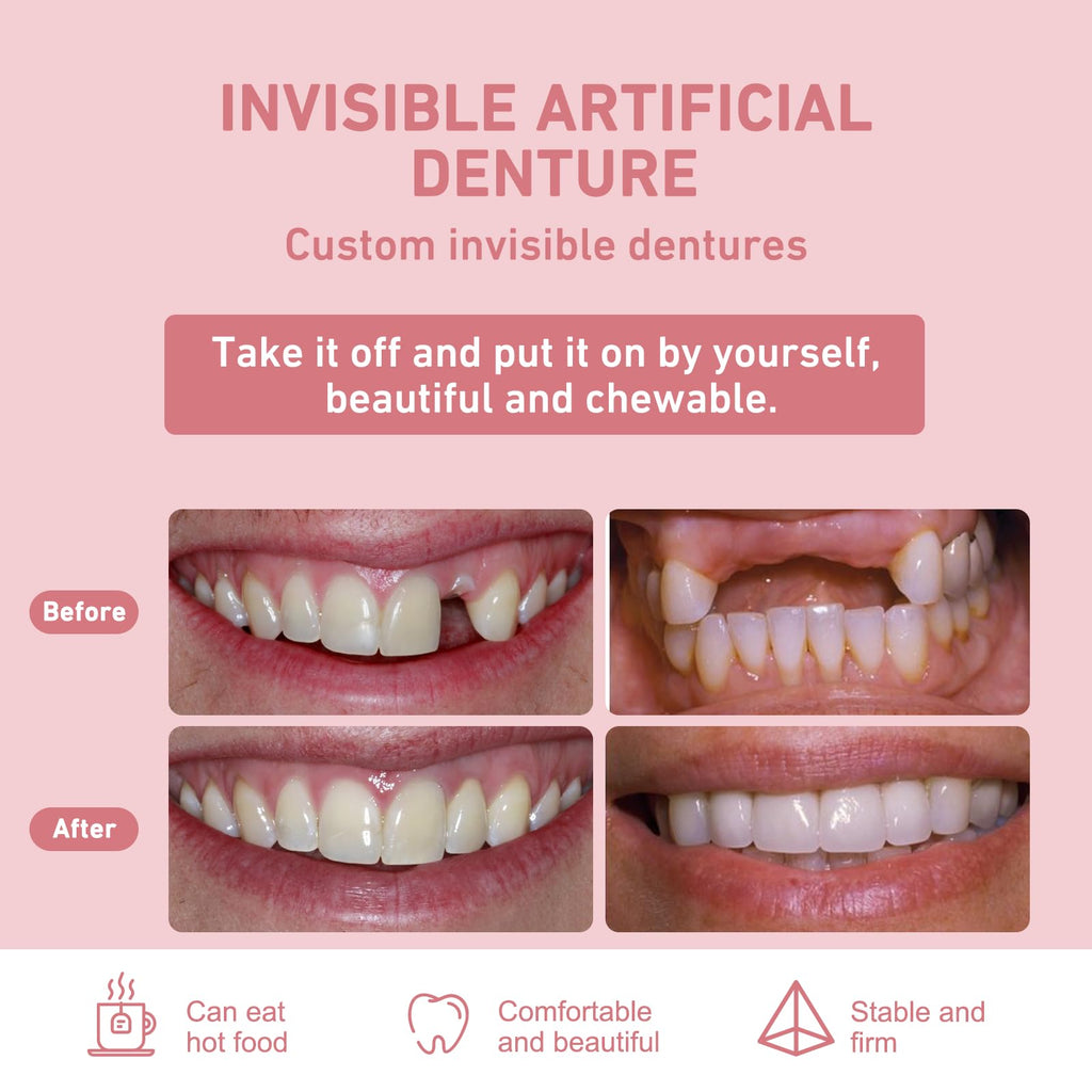 Custom Partial Dentures – Personalized Removable Denture Set for Missing Teeth | 1–6 Tooth Replacement with Storage Case | Natural Look & Comfortable Fit (1 Tooth)