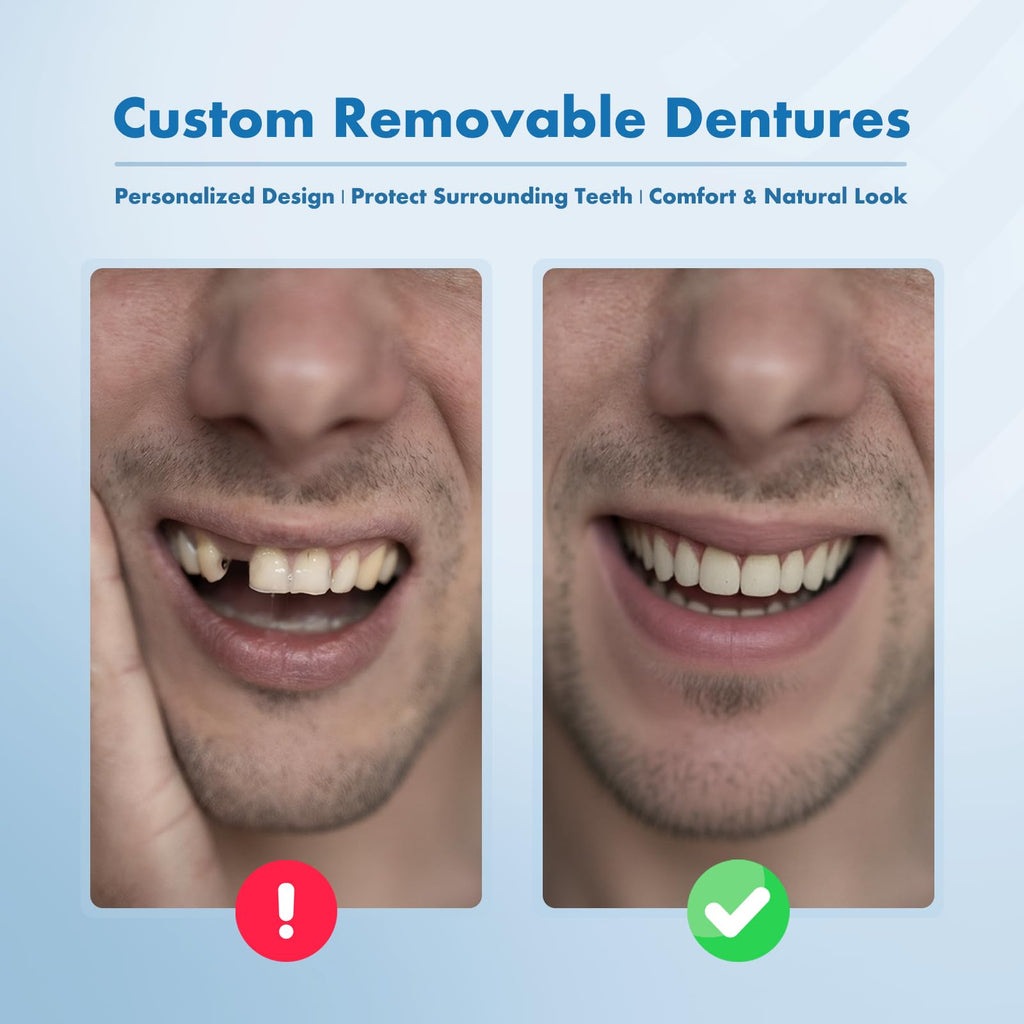 Custom Removable Dentures – Personalized Partial Denture Set with Storage Case | 1–6 Teeth Coverage