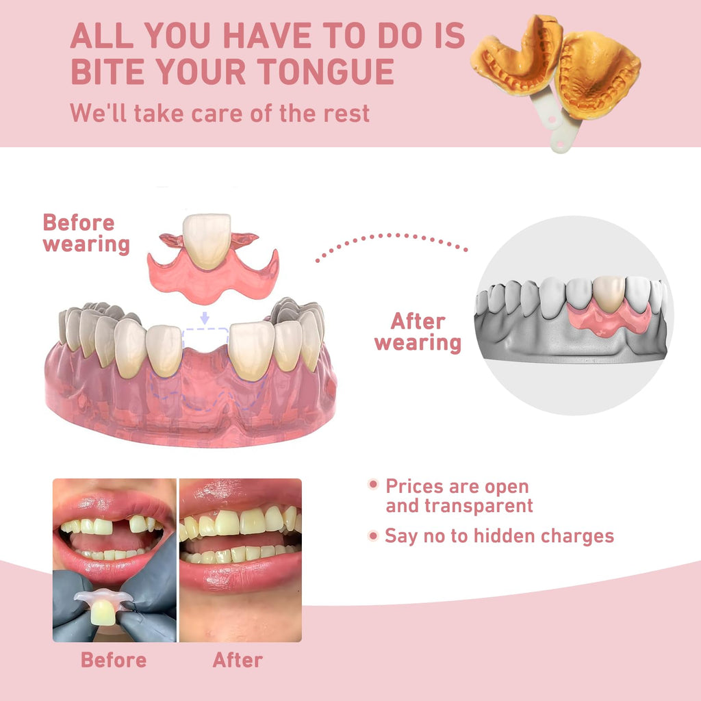 Custom Partial Dentures – Personalized Removable Denture Set for Missing Teeth | 1–6 Tooth Replacement with Storage Case | Natural Look & Comfortable Fit (4 Teeth)