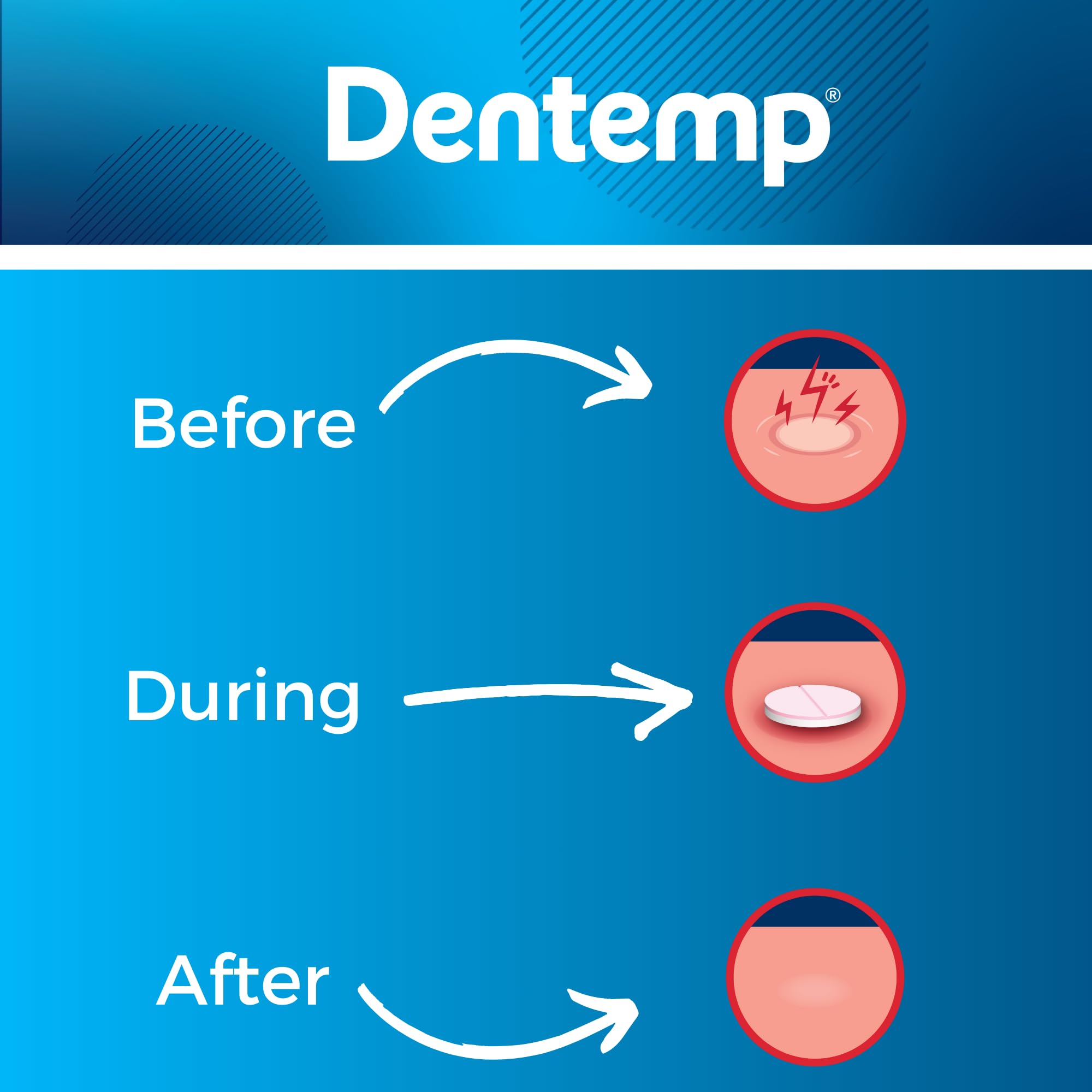 Dentemp Canker Cover – Canker Sore Pain Relief Tablets (6 Count)