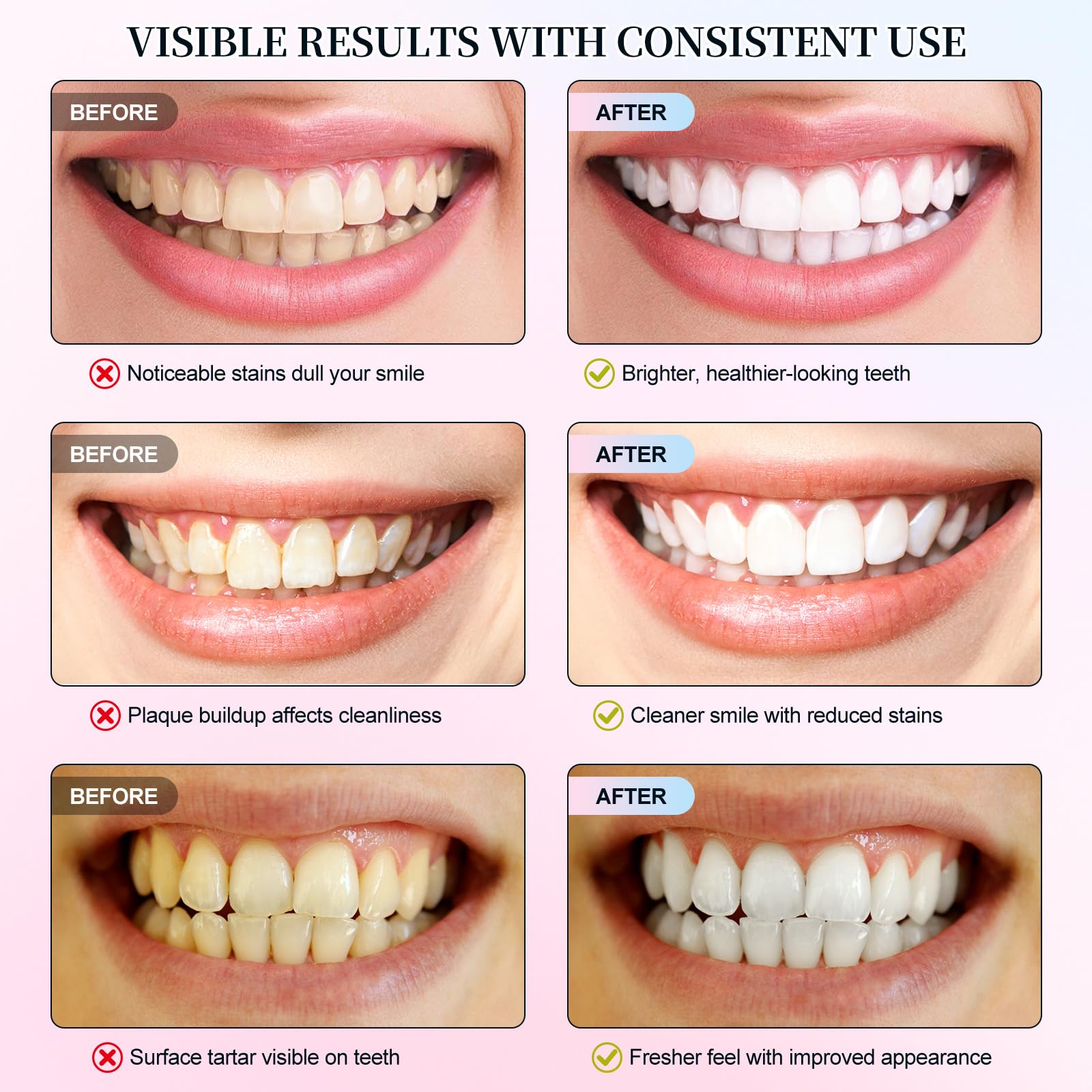 Niacinamide Whitening Toothpaste – Enamel Repair, Stain Removal (2 PCS)