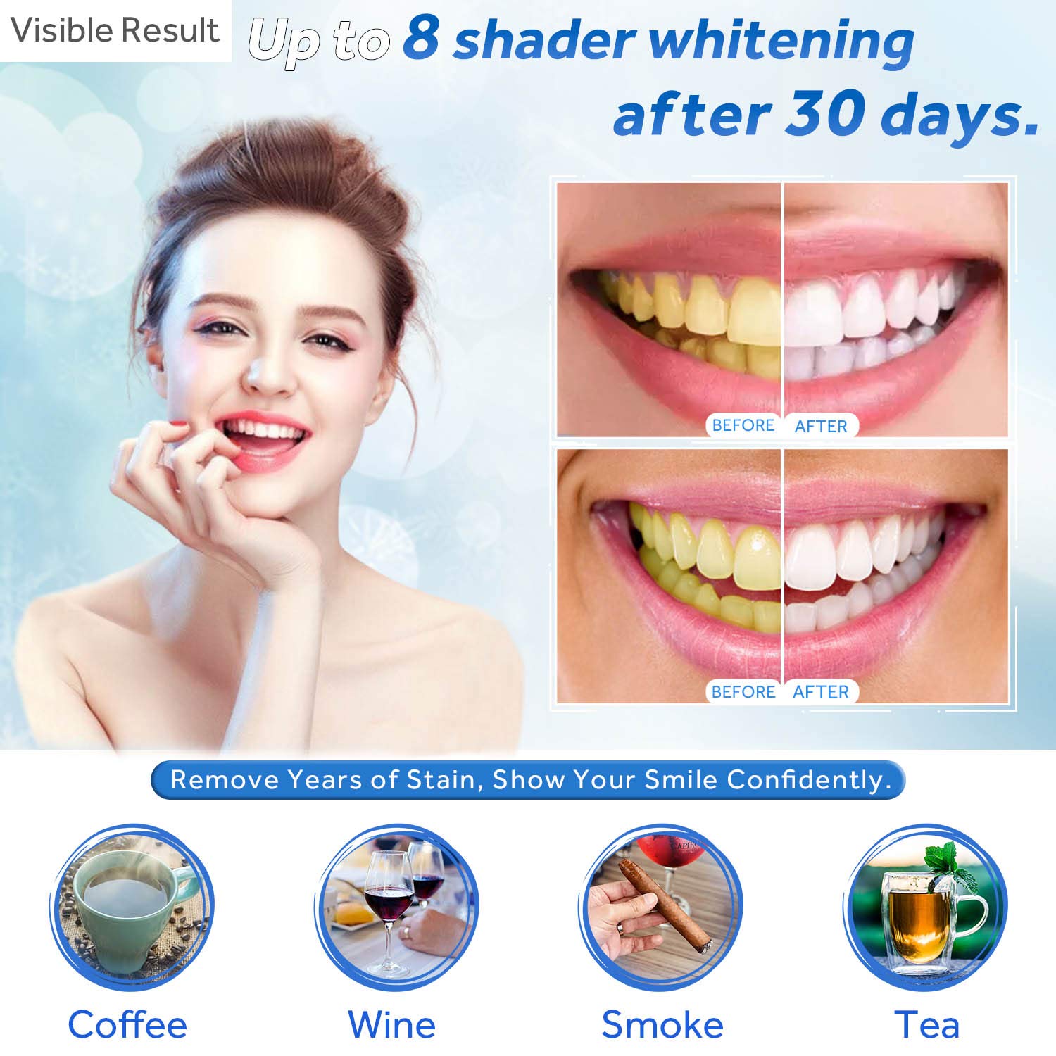 EZGO 10-Pack Teeth Whitening Gel Refills 22% - Mint Flavor (3ml x10)