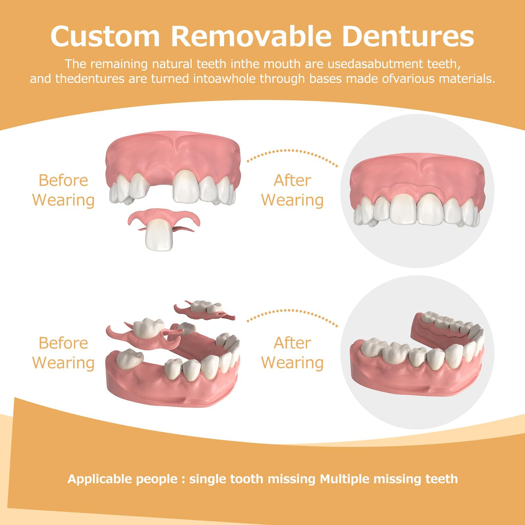 Partial Dentures (2 Teeth) – Lightweight, Durable Replacement Teeth for Missing Teeth
