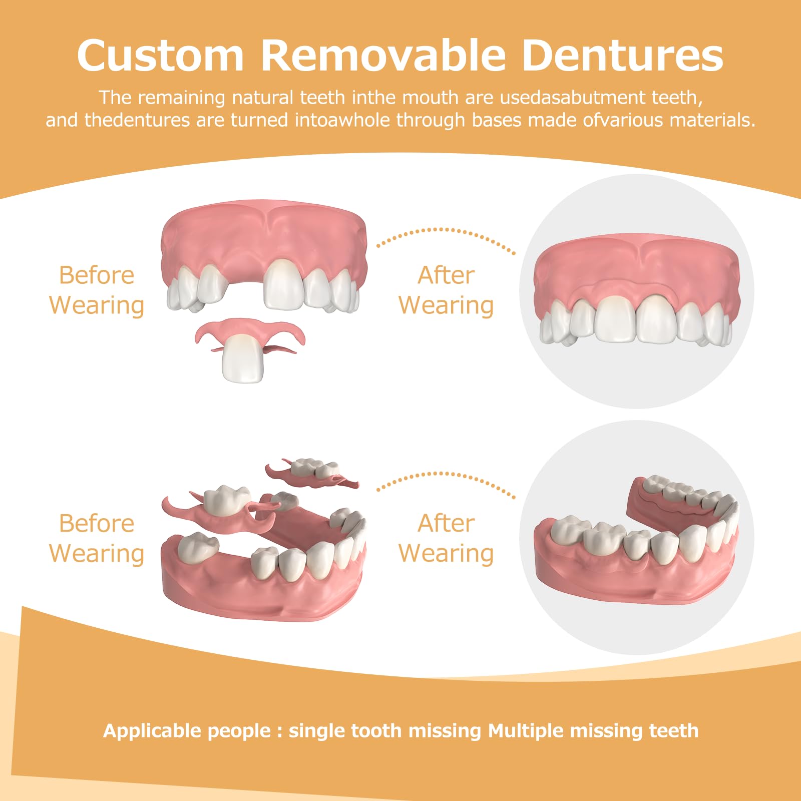 Partial Dentures (2 Teeth) – Lightweight, Durable Replacement Teeth for Missing Teeth