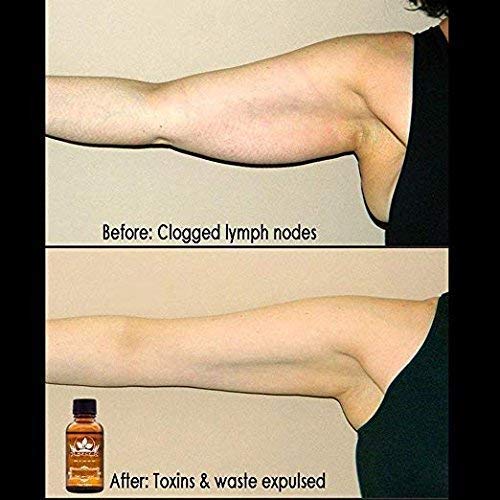 3 Pack Ginger Lymphatic Drainage Massage Oil – Boost Circulation & Metabolism (90ml)