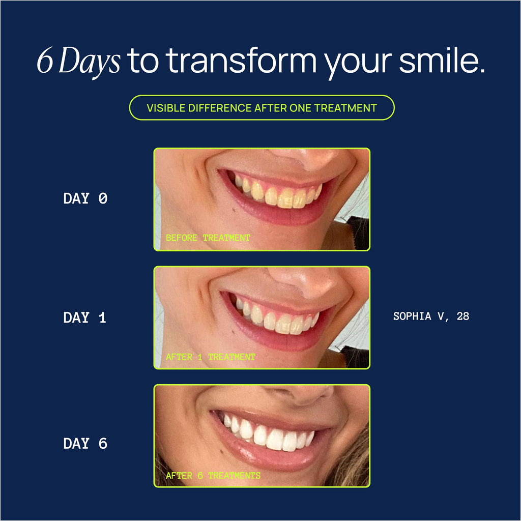 Laughland Original Teeth Whitening Gel 3 Pack - 6 Treatments, Mint, 8% Hydrogen Peroxide