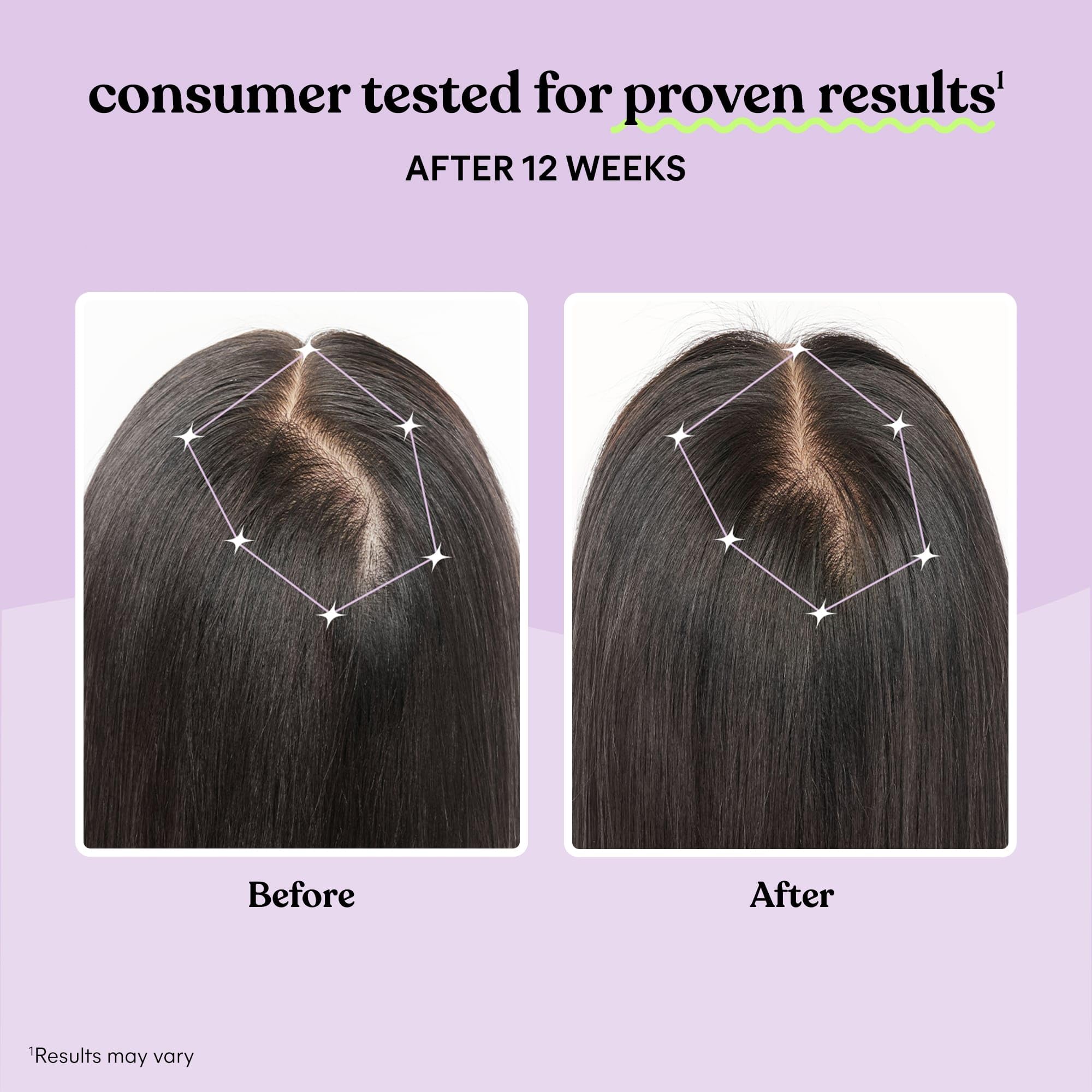 Lemme Grow Hair Supplement for Women | Keratin Complex for Thicker Hair