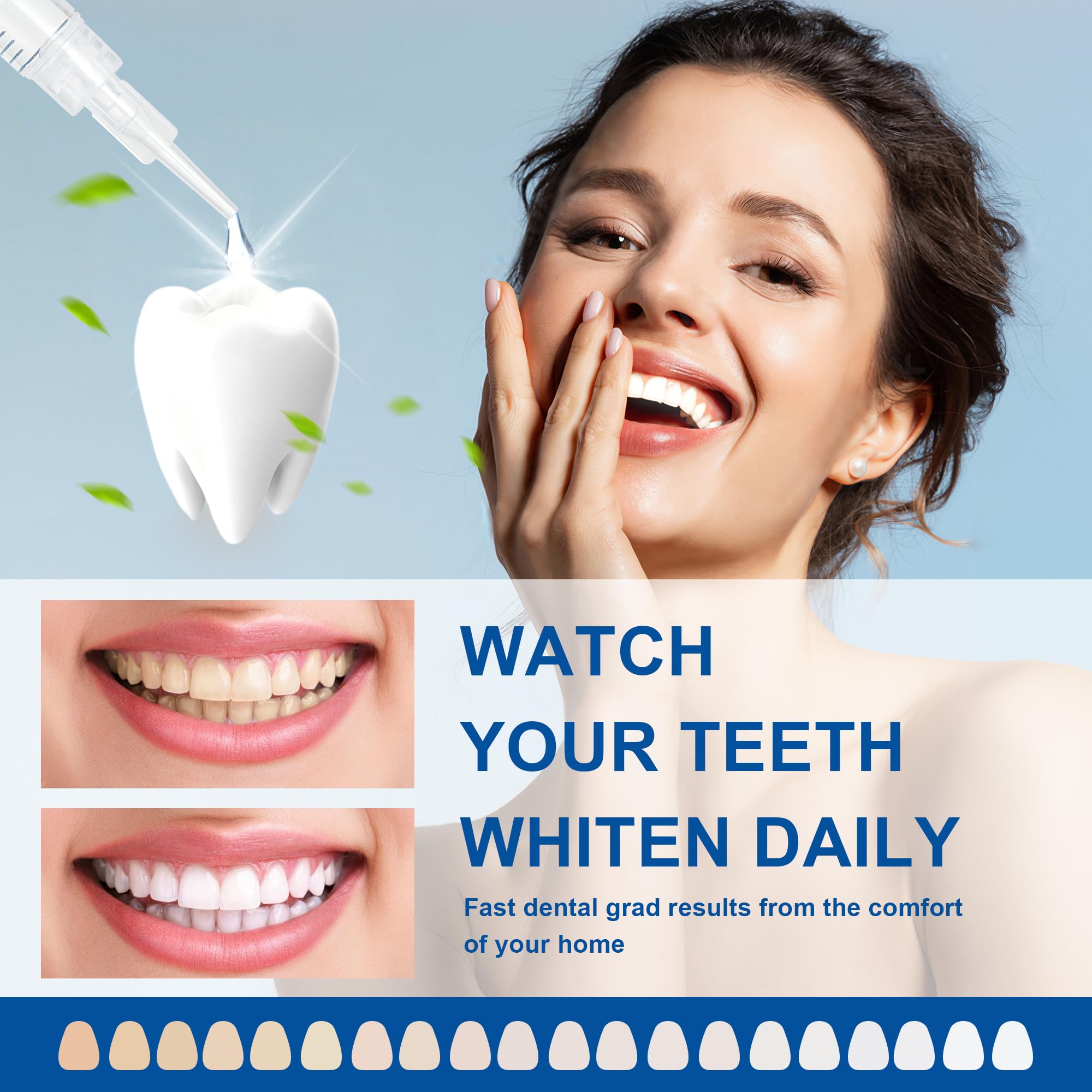 LUCKIN SMILE 10x3ml Whitening Gel Refill – 44% Carbamide Peroxide, 60 Treatments, Sensitive Teeth