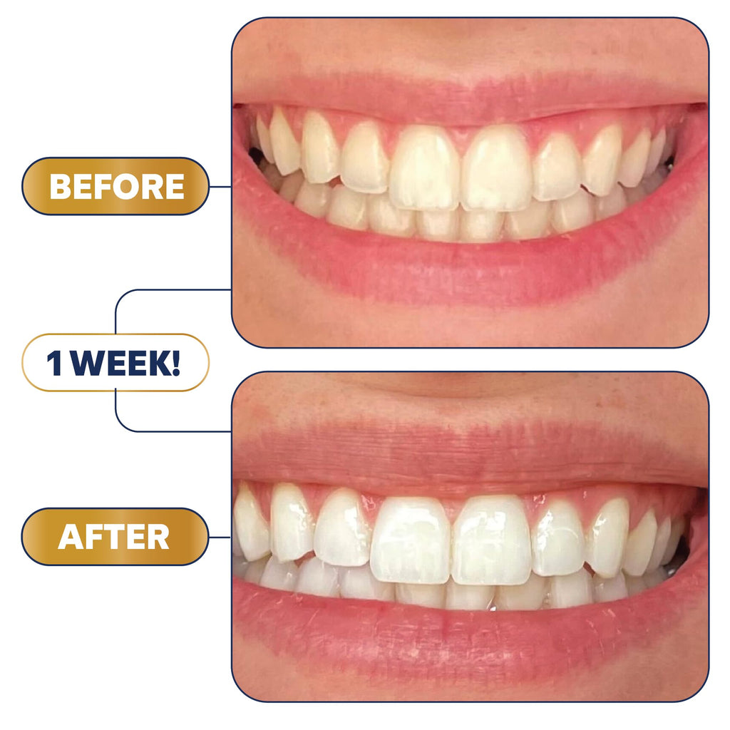 Lumineux Teeth Whitening Strips Kit – 9 Treatments | Peroxide Free, Enamel Safe, Sensitivity Free, Dentist Formulated
