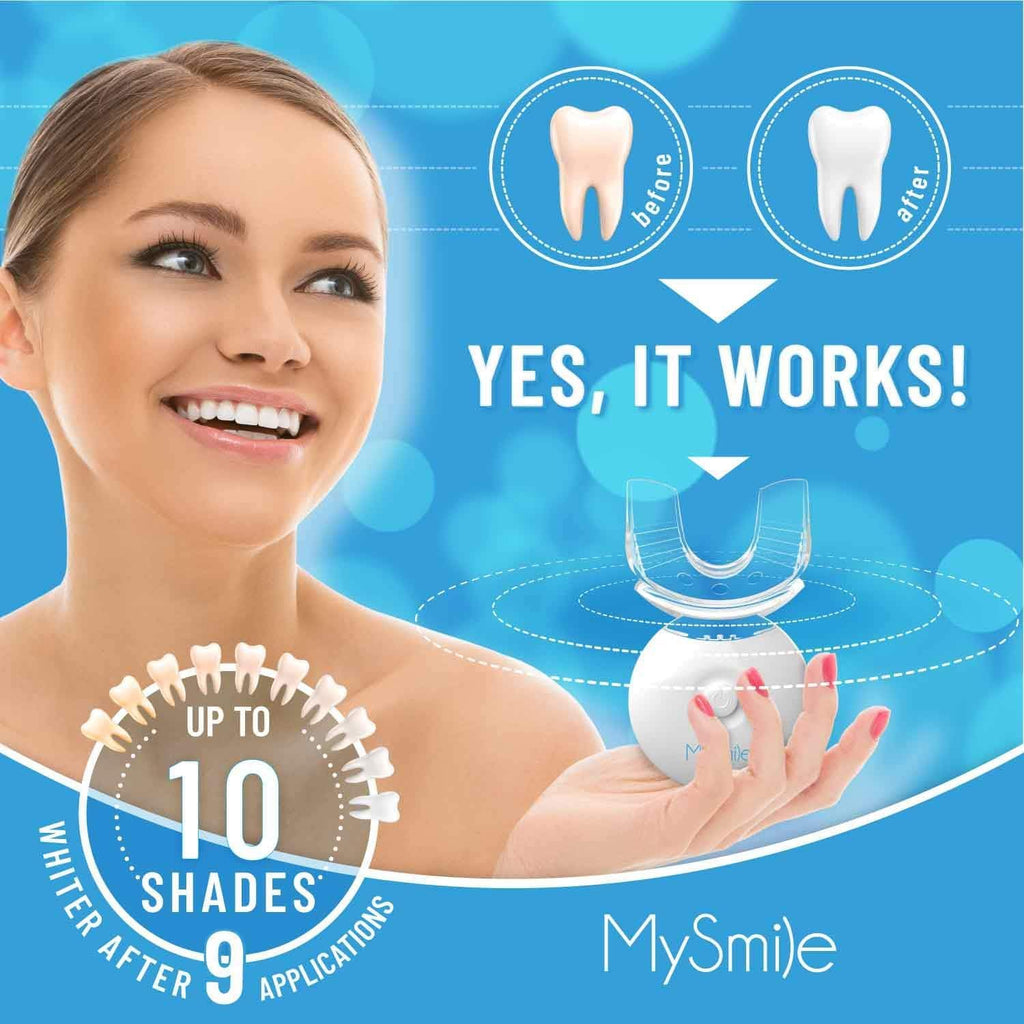 MySmile Teeth Whitening Kit with LED Light – 10 Minute Fast Whitening (35% Carbamide Peroxide)