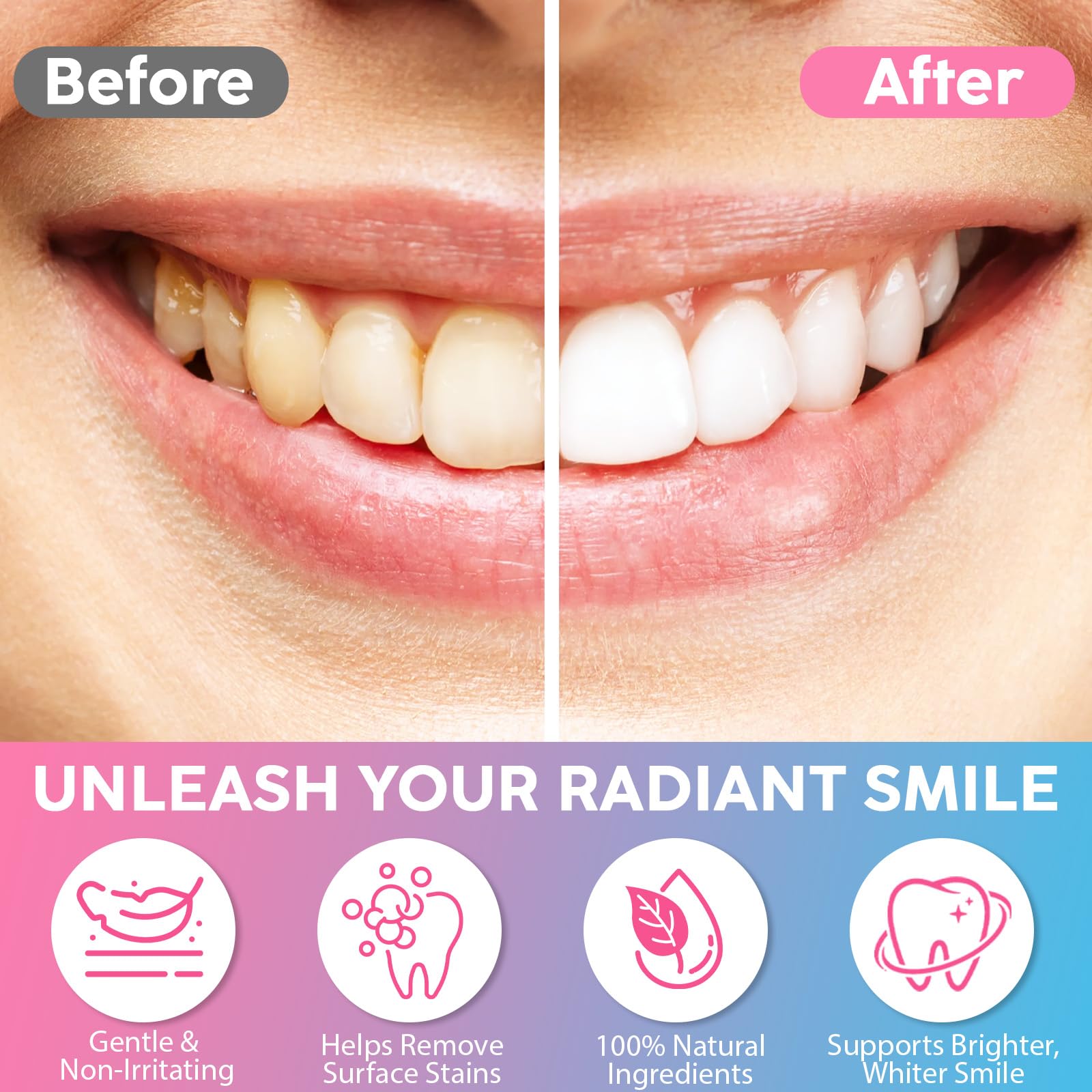 2 Pcs Niacinamide Whitening Toothpaste - Enamel Protection, Fluoride-Free, For Sensitive Teeth