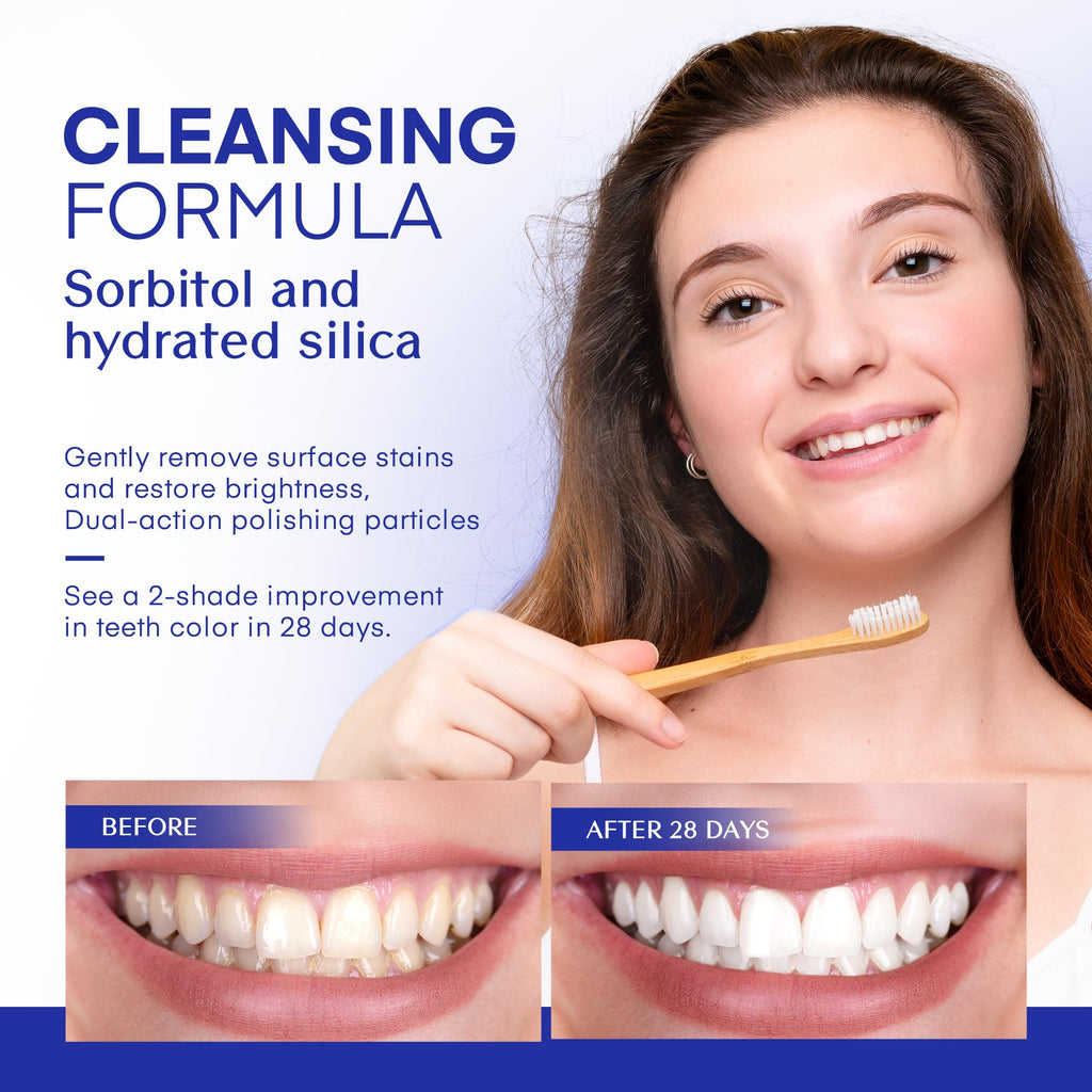 PearlSmile Niacinamide 5% + Nano-Hydroxyapatite 10% Whitening Toothpaste – Fluoride-Free, 4.2oz