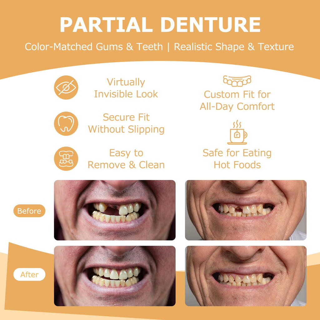 Partial Dentures (2 Teeth) – Lightweight, Durable Replacement Teeth for Missing Teeth