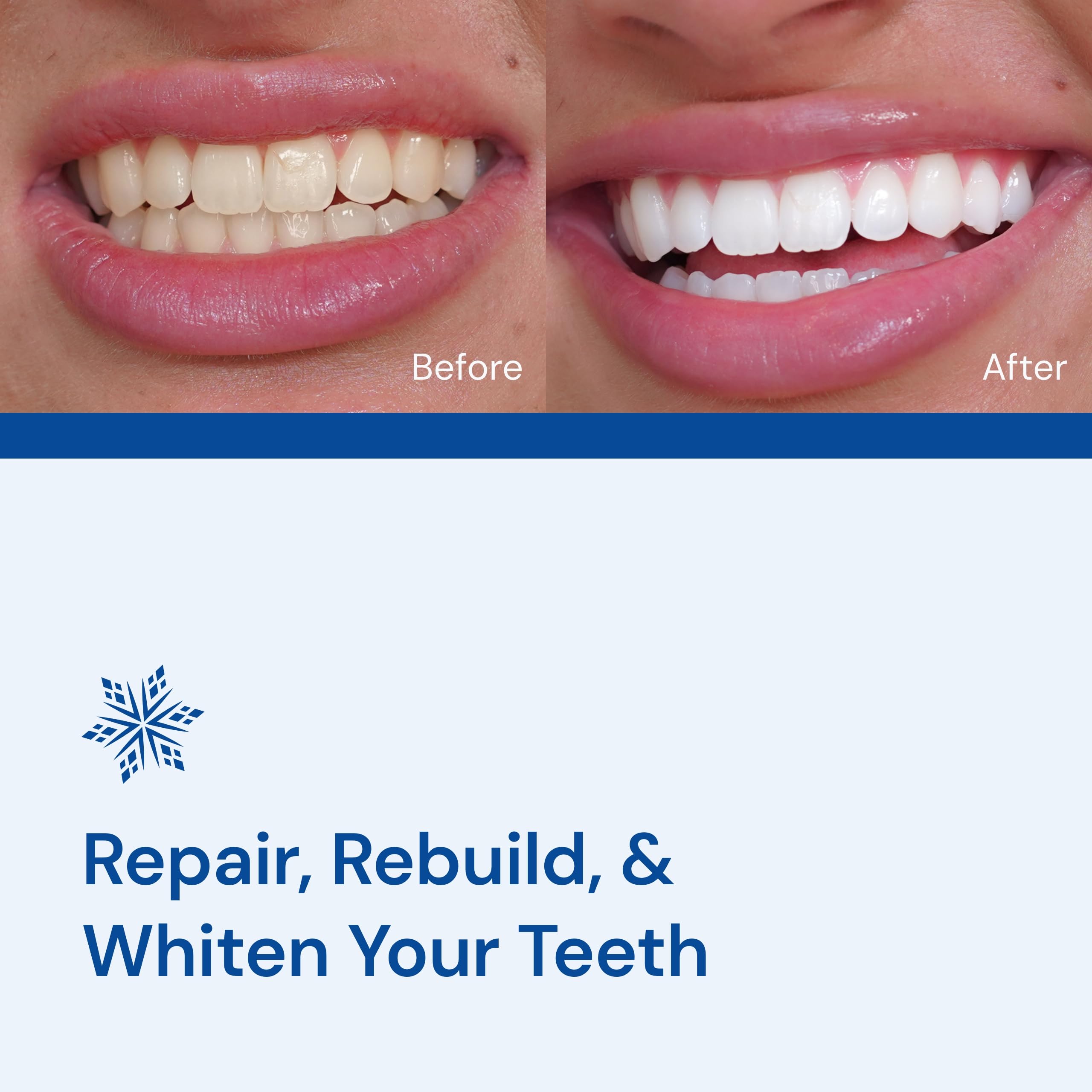 Snow Teeth Whitening Kit - Snow Teeth Whitening Serum and LED Mouthpiece Whitener, Formulated with Hydroxyapatite, Good for 2 Months - Wired Kit with 1 Wand