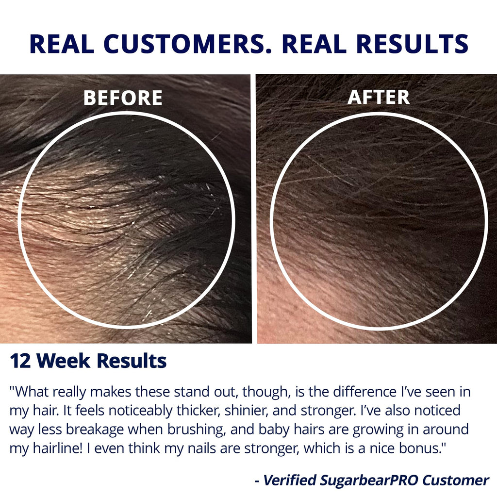 SugarBearHair Growth Gummy - Extra Strength Biotin 6000mcg, 2 Month Supply, Vegan & Cruelty-Free