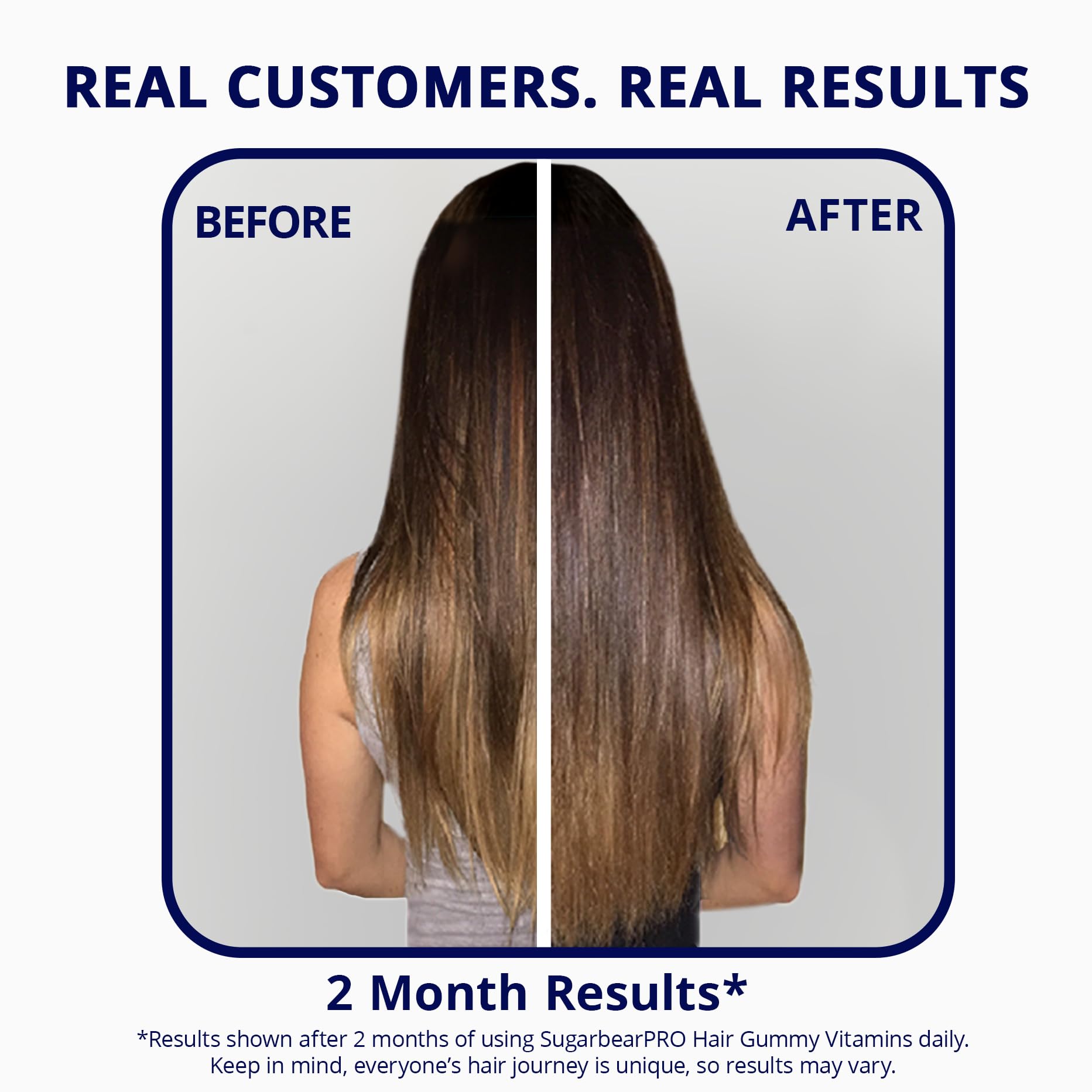 SugarBearPro Hair Vitamin Gummy - 14 Day Supply, 6000mcg Biotin, Growth for Men & Women, Vegan, Kosher, Halal, Cruelty-Free
